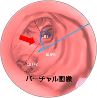 バーチャル画像