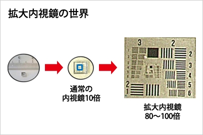 拡大内視鏡の世界