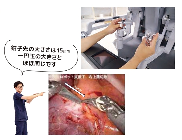 肺がんダヴィンチ手術のご案内 - クローズアップ - 病院のご案内